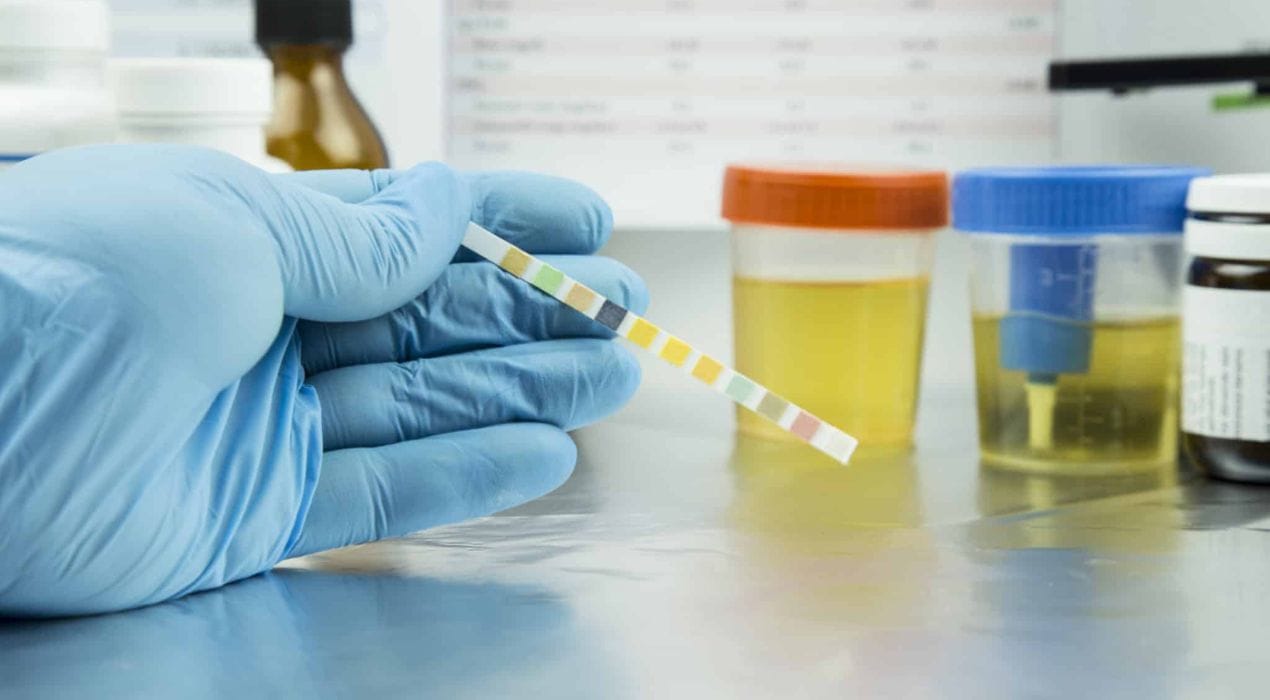 مذكرة دفاع في قضية تحليل مخدرات